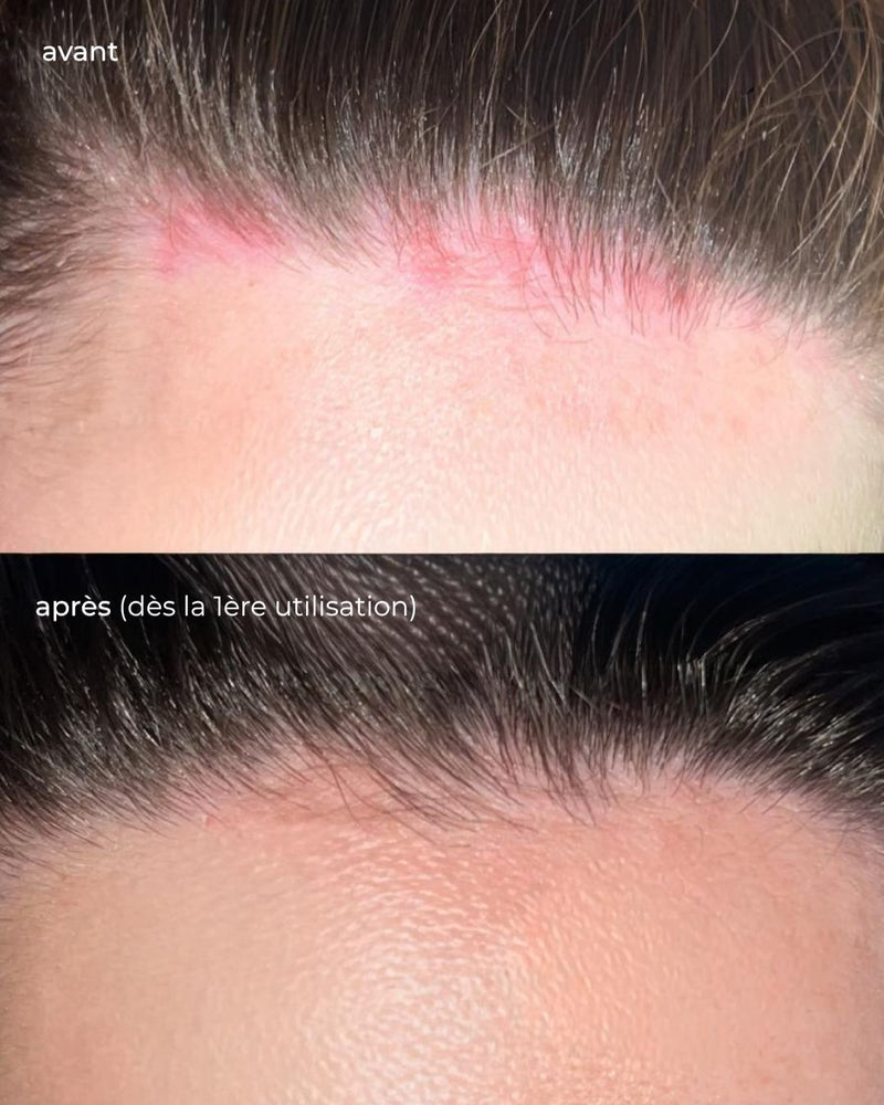 Routine purifiante